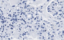 Anti-PARP-1 Antibody, clone 12N17 Antibody, ZooMAb&#174; Rabbit Monoclonal recombinant, expressed in HEK 293 cells