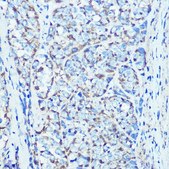 Anti-ATPB antibody produced in rabbit