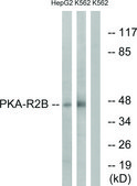 Anti-PKA-R2 &#946; antibody produced in rabbit affinity isolated antibody