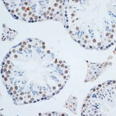 Anti- HMGB1 antibody produced in rabbit