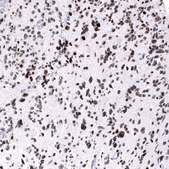Monoclonal Anti-EZH2 antibody produced in mouse Prestige Antibodies&#174; Powered by Atlas Antibodies, clone CL11945, purified immunoglobulin, buffered aqueous glycerol solution