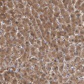 Anti-ALDH8A1 antibody produced in rabbit Prestige Antibodies&#174; Powered by Atlas Antibodies, affinity isolated antibody, buffered aqueous glycerol solution