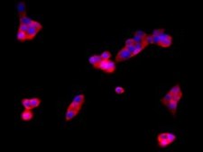 INS-1E Rat Insulinoma Beta Cell Line