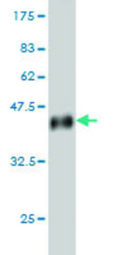 Monoclonal Anti-UPK1B antibody produced in mouse clone 1E1, purified immunoglobulin, buffered aqueous solution