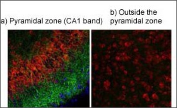 Anti-TRPV4 antibody produced in rabbit affinity isolated antibody