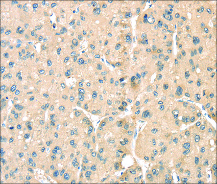 Anti-LOXL3 affinity isolated antibody