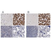 Anti-DECR1 antibody produced in rabbit Prestige Antibodies&#174; Powered by Atlas Antibodies, affinity isolated antibody, buffered aqueous glycerol solution, Ab3