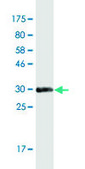 Monoclonal Anti-RNF170 antibody produced in mouse clone 2D6, purified immunoglobulin, buffered aqueous solution