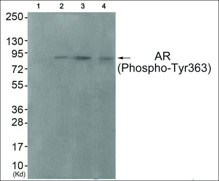 Anti-phospho-Androgen Receptor (pTyr363) antibody produced in rabbit affinity isolated antibody