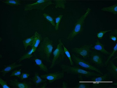 Anti-SETBP1 antibody produced in mouse purified immunoglobulin, buffered aqueous solution