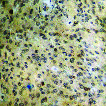 Anti-phospho-ATF2 (pThr69 or 51) antibody produced in rabbit affinity isolated antibody