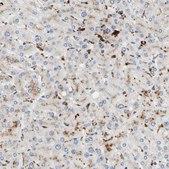 Anti-CECR1 antibody produced in rabbit Prestige Antibodies&#174; Powered by Atlas Antibodies, affinity isolated antibody, buffered aqueous glycerol solution