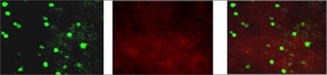 Anti-KCNAB1 antibody produced in rabbit affinity isolated antibody