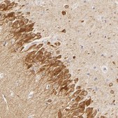 Anti-DLG3 antibody produced in rabbit Prestige Antibodies&#174; Powered by Atlas Antibodies, affinity isolated antibody, buffered aqueous glycerol solution
