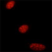 Monoclonal Anti-Proliferating Cell Protein Ki-67 antibody produced in mouse clone PP-67, ascites fluid