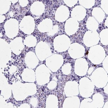 Anti-ZDHHC7 antibody produced in rabbit Prestige Antibodies&#174; Powered by Atlas Antibodies, affinity isolated antibody, buffered aqueous glycerol solution