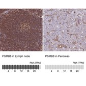 Anti-PSMB8 antibody produced in rabbit Prestige Antibodies&#174; Powered by Atlas Antibodies, affinity isolated antibody, buffered aqueous glycerol solution