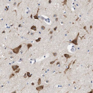 Anti-UBE2G2 antibody produced in rabbit Prestige Antibodies&#174; Powered by Atlas Antibodies, affinity isolated antibody, buffered aqueous glycerol solution