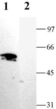 Anti-Potassium Channel Kir2.1 Antibody Chemicon&#174;, from rabbit