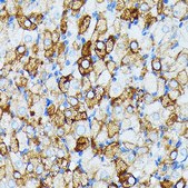 Anti-JAK1 Antibody, clone 7Q1B2, Rabbit Monoclonal