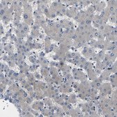 Anti-ERBB4 antibody produced in rabbit Prestige Antibodies&#174; Powered by Atlas Antibodies, affinity isolated antibody, buffered aqueous glycerol solution