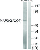 Anti-MAP3K8 antibody produced in rabbit affinity isolated antibody