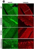Anti-Vesicular Glutamate Transporter 2 Antibody clone 8G9.2, Chemicon&#174;, from mouse