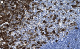 Anti-TYMS Antibody, clone 1E20 ZooMAb&#174; Rabbit Monoclonal recombinant, expressed in HEK 293 cells