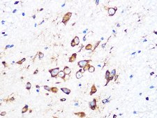 Anti-PUMA antibody produced in rabbit