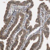 Anti-UBQLN2 antibody produced in rabbit Prestige Antibodies&#174; Powered by Atlas Antibodies, affinity isolated antibody, buffered aqueous glycerol solution