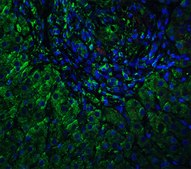 Anti-VPS39 antibody produced in rabbit affinity isolated antibody