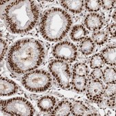 Anti-EYA2 antibody produced in rabbit Prestige Antibodies&#174; Powered by Atlas Antibodies, affinity isolated antibody, buffered aqueous glycerol solution