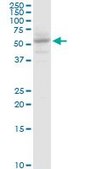 Monoclonal Anti-SLC13A5 antibody produced in mouse clone 2G4, purified immunoglobulin, buffered aqueous solution