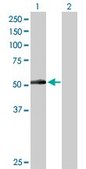 Anti-PNPLA3 antibody produced in rabbit purified immunoglobulin, buffered aqueous solution