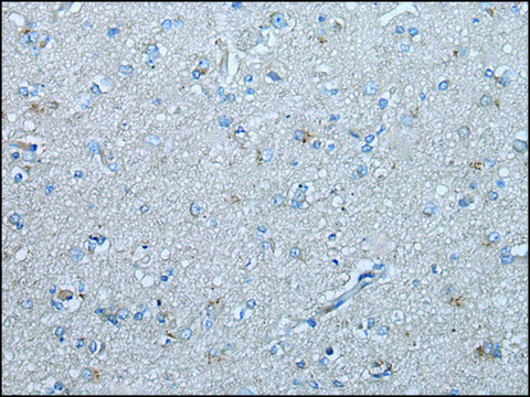 Anti-UBR4 affinity isolated antibody