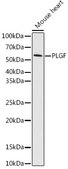 Anti-PLGF Antibody, clone 6N4V2, Rabbit Monoclonal
