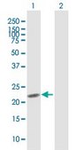 Anti-PDE4DIP antibody produced in mouse purified immunoglobulin, buffered aqueous solution