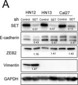 Anti-Vimentin antibody, Mouse monoclonal clone V9, purified from hybridoma cell culture