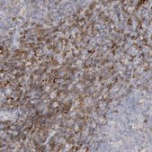 Anti-C1QC antibody produced in rabbit Prestige Antibodies&#174; Powered by Atlas Antibodies, affinity isolated antibody, buffered aqueous glycerol solution