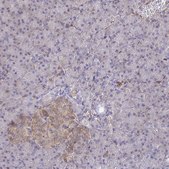 Anti-WNK1 antibody produced in rabbit Prestige Antibodies&#174; Powered by Atlas Antibodies, affinity isolated antibody, buffered aqueous glycerol solution