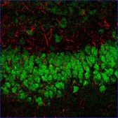 Anti-Human IgG (H+L), highly cross-adsorbed, CF&#8482; 633 antibody produced in donkey ~2&#160;mg/mL, affinity isolated antibody