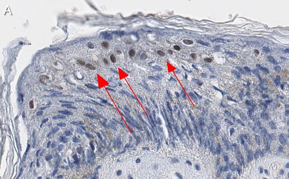 Anti-GRHL2 Antibody, clone 2N18 ZooMAb&#174; Rabbit Monoclonal recombinant, expressed in HEK 293 cells