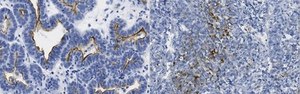 Anti-Mucin-16 (CA-125) Antibody, clone 5E11 clone 5E11, from mouse