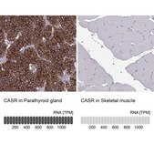 Anti-CASR antibody produced in rabbit Prestige Antibodies&#174; Powered by Atlas Antibodies, affinity isolated antibody, buffered aqueous glycerol solution