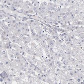 Anti-MGAM antibody produced in rabbit Prestige Antibodies&#174; Powered by Atlas Antibodies, affinity isolated antibody, buffered aqueous glycerol solution