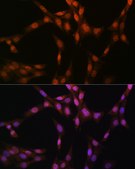 Anti-Glutathione Synthetase (GSS) Antibody, clone 2S9W7, Rabbit Monoclonal