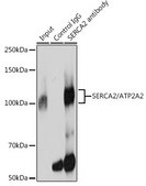Anti-SERCA2/ATP2A2 antibody produced in rabbit