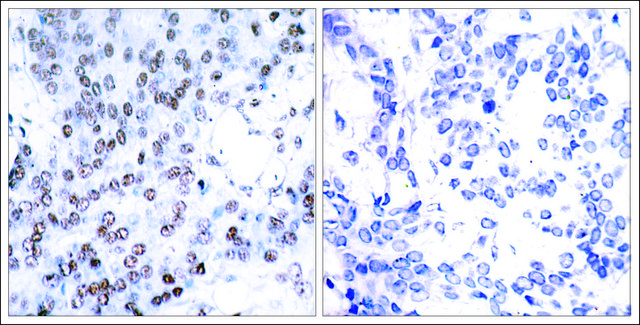 Anti-JUNB (Ab-79) antibody produced in rabbit affinity isolated antibody