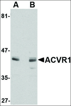 Anti-ACVR1 antibody produced in rabbit affinity isolated antibody, buffered aqueous solution