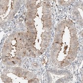 Anti-CEP162 antibody produced in rabbit Prestige Antibodies&#174; Powered by Atlas Antibodies, affinity isolated antibody, buffered aqueous glycerol solution, ab1